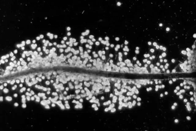 An up close, abstract image of a spore-like network along a main tubal